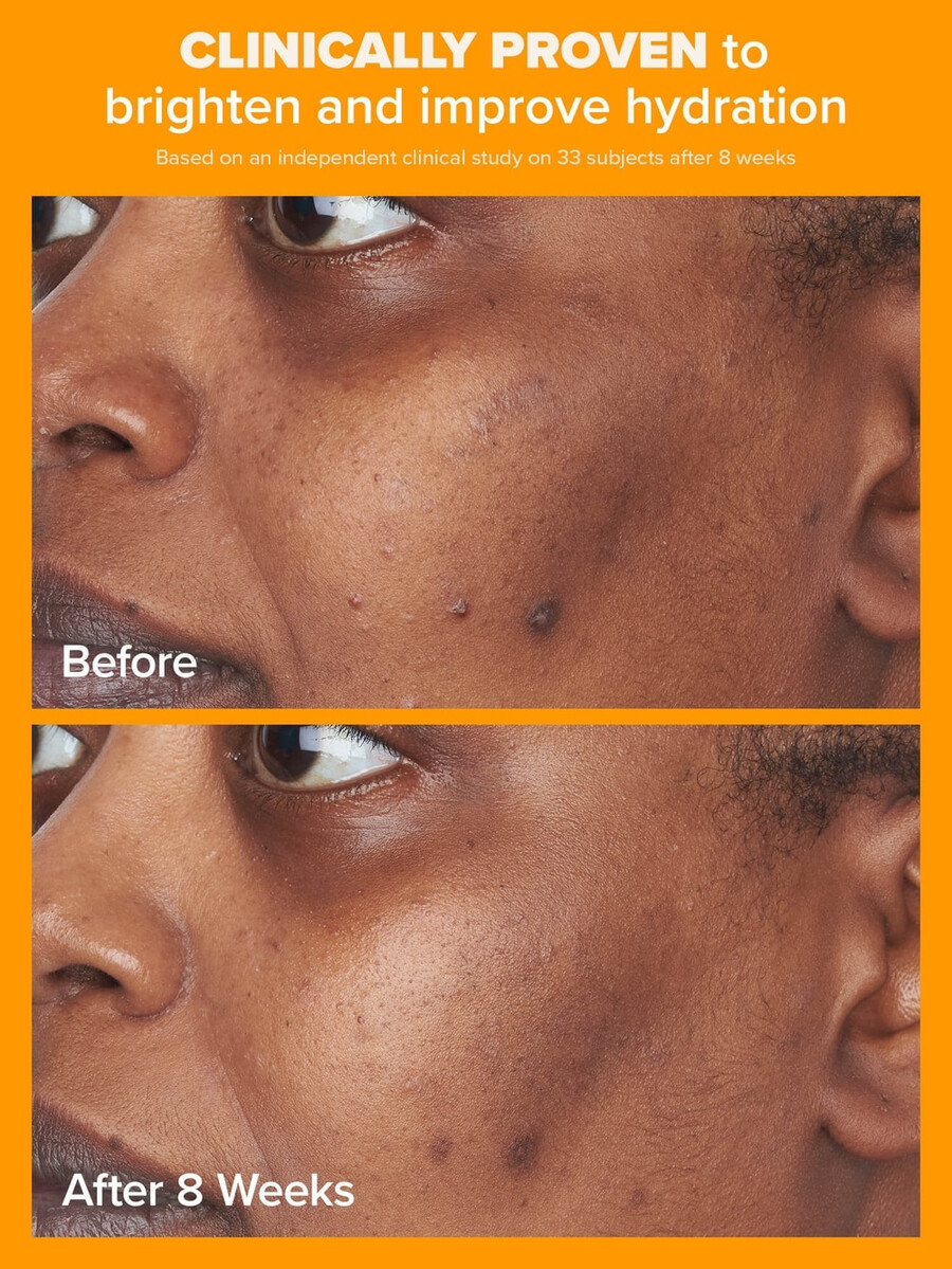 cremă hidratantă transparentă cu 5 vitamina c spf 50